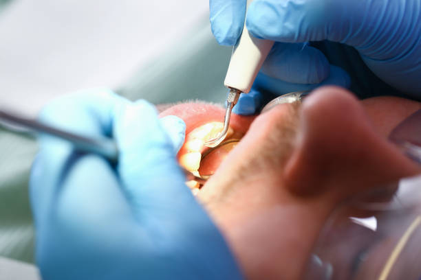 Best Same-Day Emergency Dentist in Powderly, TX
