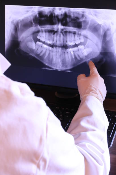 Best Emergency Root Canal Treatment in Powderly, TX