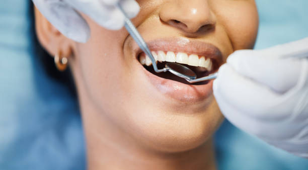 Best Emergency Wisdom Teeth Removal in Powderly, TX