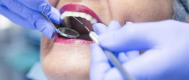Best Emergency Wisdom Teeth Removal in Powderly, TX