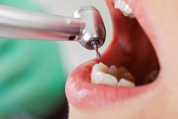  Powderly, TX Emergency Dentist Pros